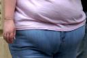 Women accounted for 2,530, or 70 per cent, of North Somerset’s obesity-related hospital admissions during 2018-19.