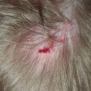 A four-year-old boy was rushed to Weston General Hospital after a piece of glass was lodged in the back of his head due to a fall at a skatepark.